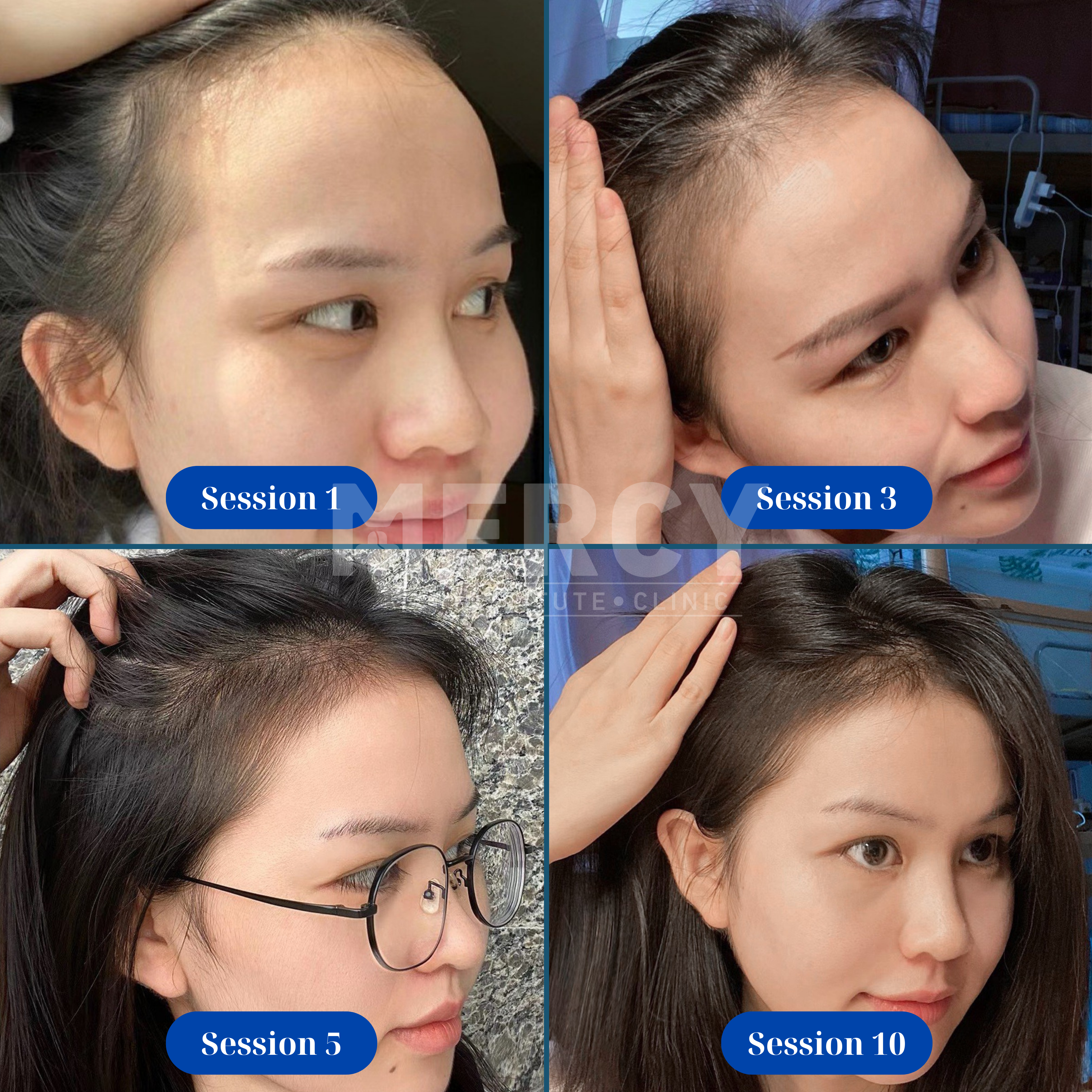 Hair Treatment